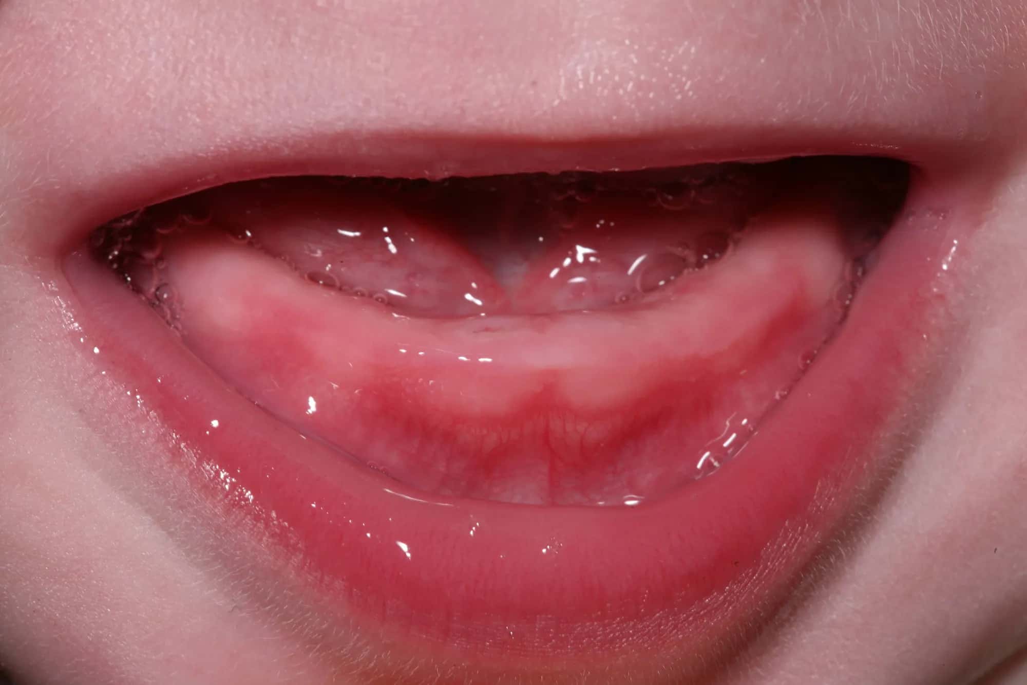 A baby's smile close up, two tiny teeth just showing at the bottom gum