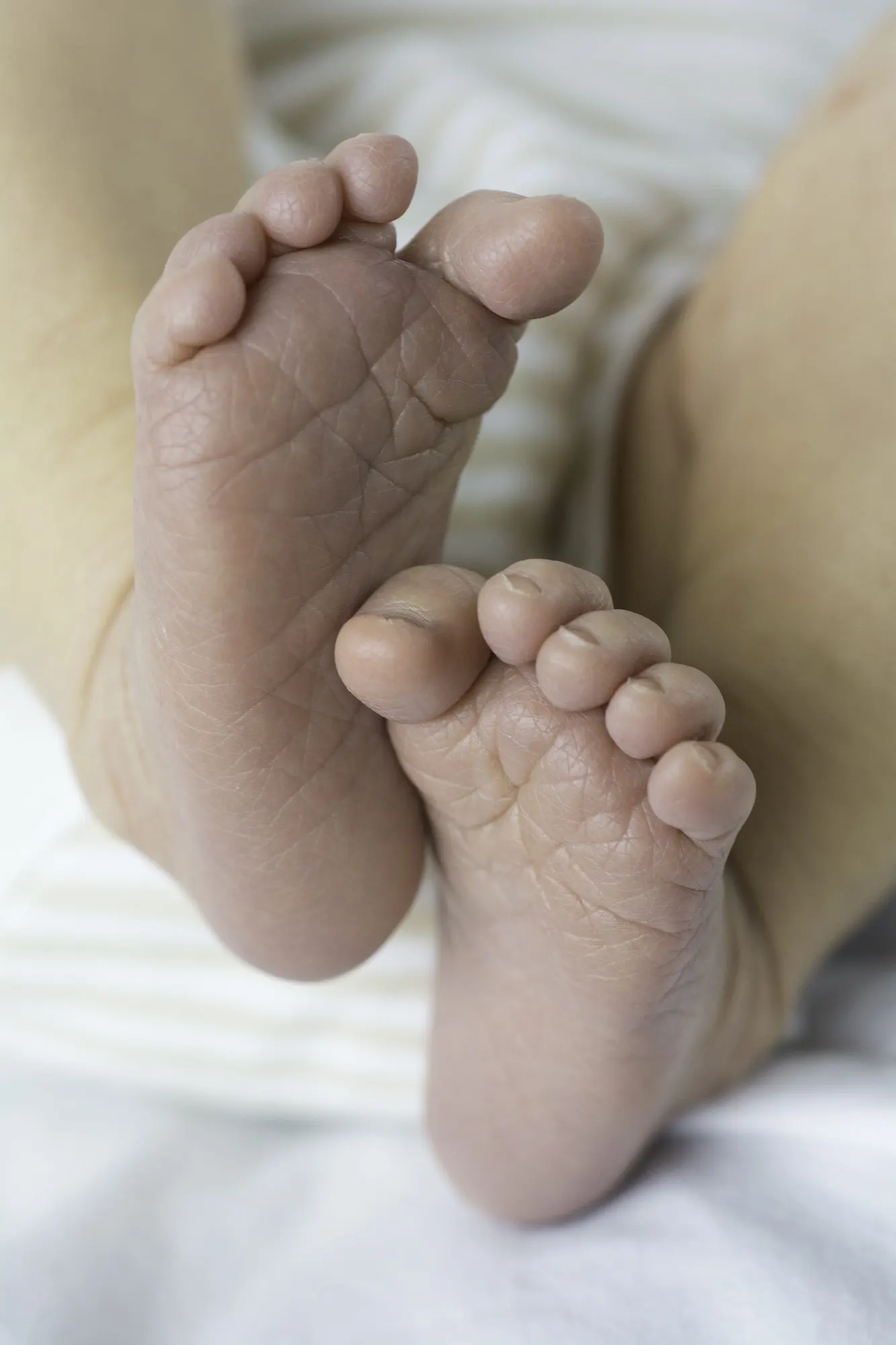 A baby's curled toes and wrinkled soles against a striped blanket